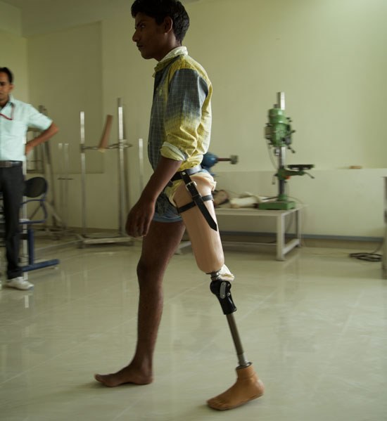 A patient is fit with a prototype of the ReMotion Knee in May 2015 at the Jaipur Foot Clinic.